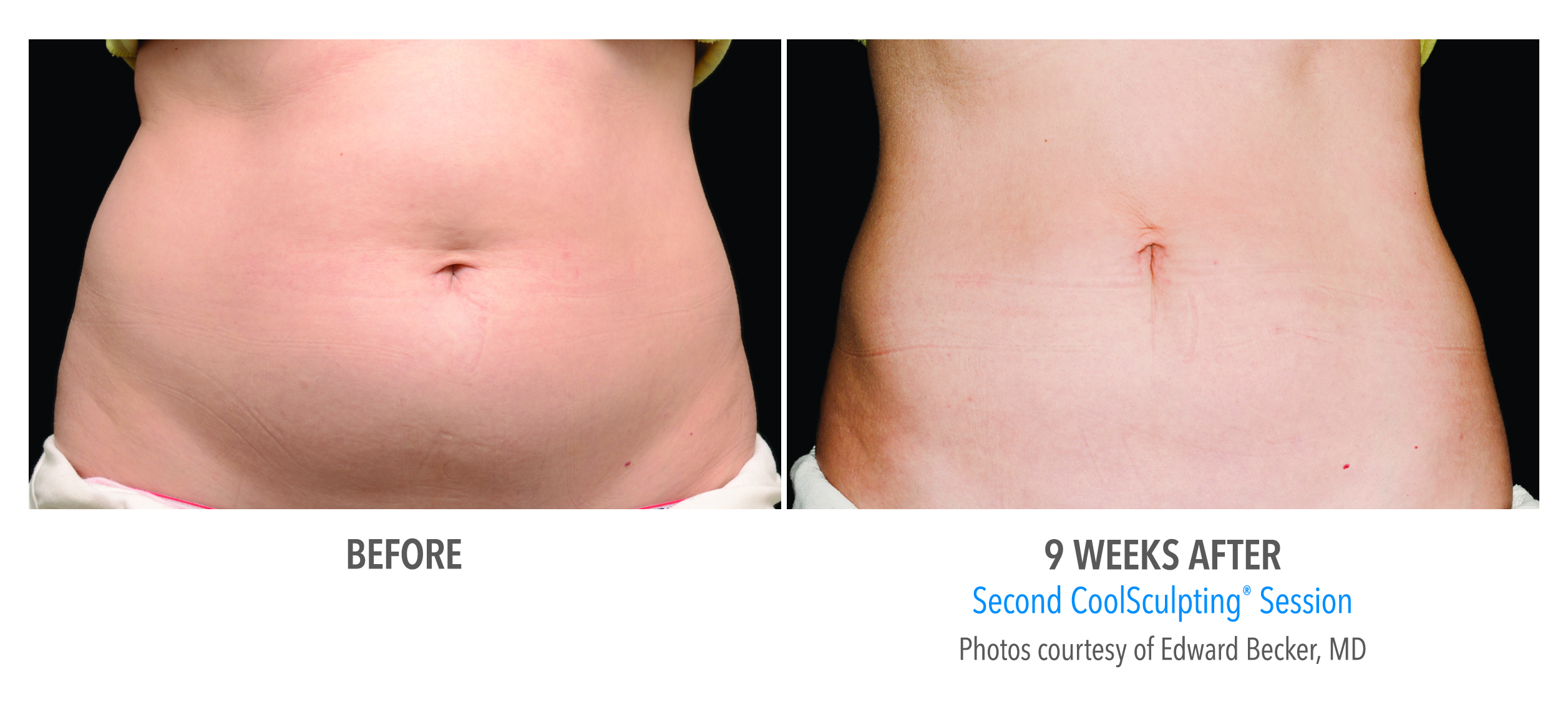 Before and After Photos